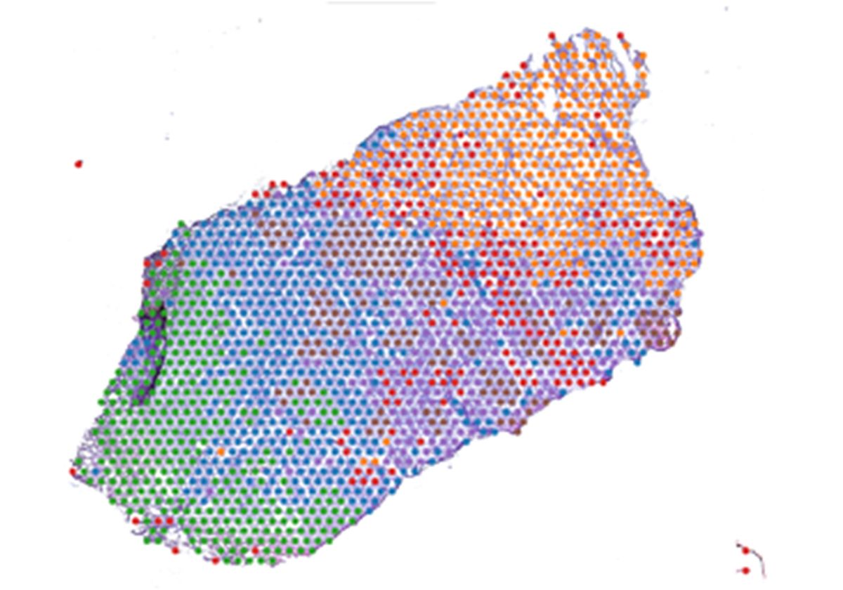 Image of spatial transcriptomic spots superimposed onto a stained tissue section.
