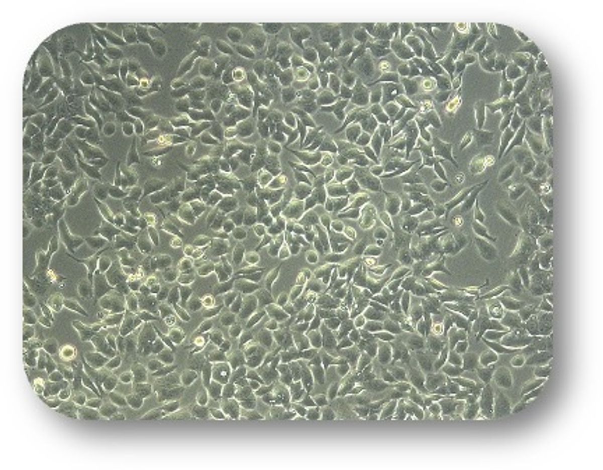 Microscopy image of <em >EGFR</em>-mutant patient-derived cancer cells