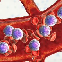 3D medical illustration showing acute lymphoblastic leukemia cells and red blood cells in circulation.
