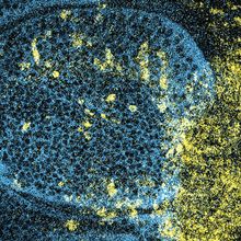 A colored microscopy image showing cells that are dying in yellow and healthy cells in blue&nbsp;