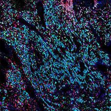 A fluorescence microscopy image of placenta tissue made up of cells dyed blue, purple, pink and green on a black background.