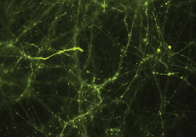 The image shows many neurons in culture expressing the glutamate reporter iGluSnFR3 in green.