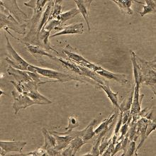 A microscopy image of several endometrial stromal fibroblasts