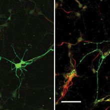 An APP-knockout neuron (right) shows extended axonal and reduced dendritic growth compared with a normal mouse neuron (left). Scale bar 50 µm.