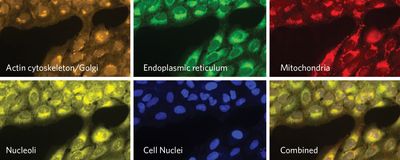 The image shows six different panels containing cells. On each panel, the cells are labelled using a different fluorescent dye that highlights features of a specific organelle within the cells.