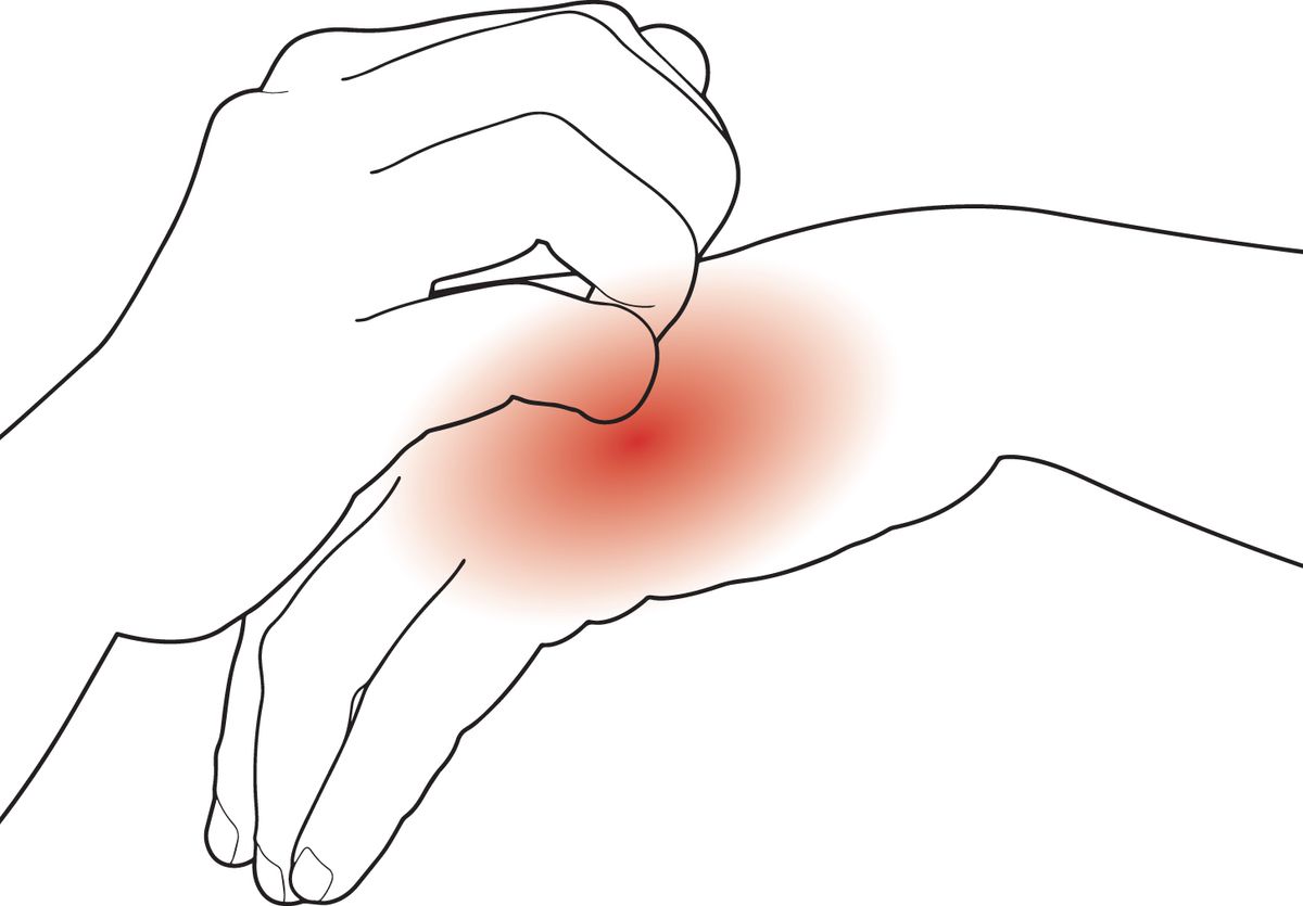 Illustration of hands scratching.