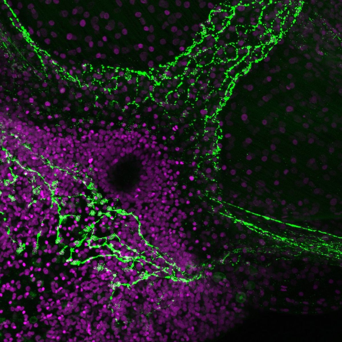 The image shows the base of a jellyfish’s tentacle and the animal’s eyelet. The neurons expressing the peptide of interest are shown in green, and the cell nuclei are labeled in magenta. The jellyfish is against a black background. 