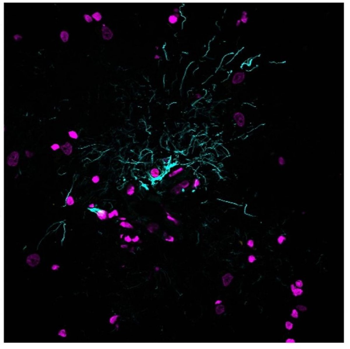 Lipofuscin autofluorescence was quenched using EverBrite TrueBlack® Hardset Mounting Medium®, allowing effective visualization of glial cells (GFAP antibody stain, cyan) and cell nuclei (magenta) in human cerebral cortex cryosections.