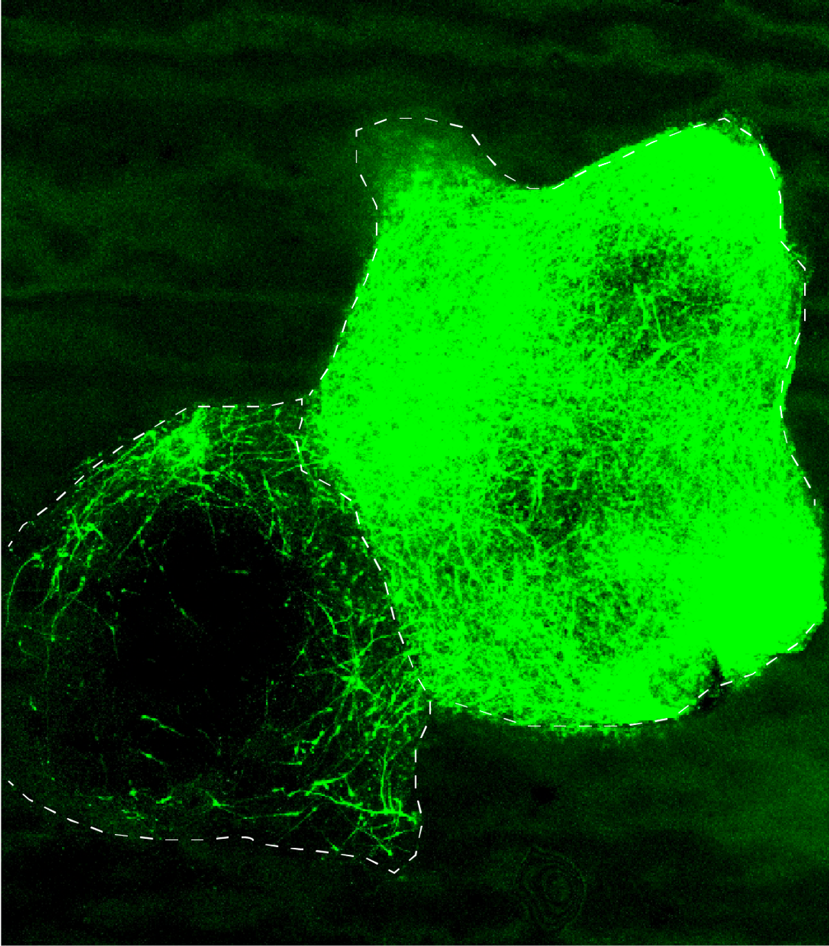 Fluorescent image of interneurons, shown in green color, migrating from one blob-like structure into another.