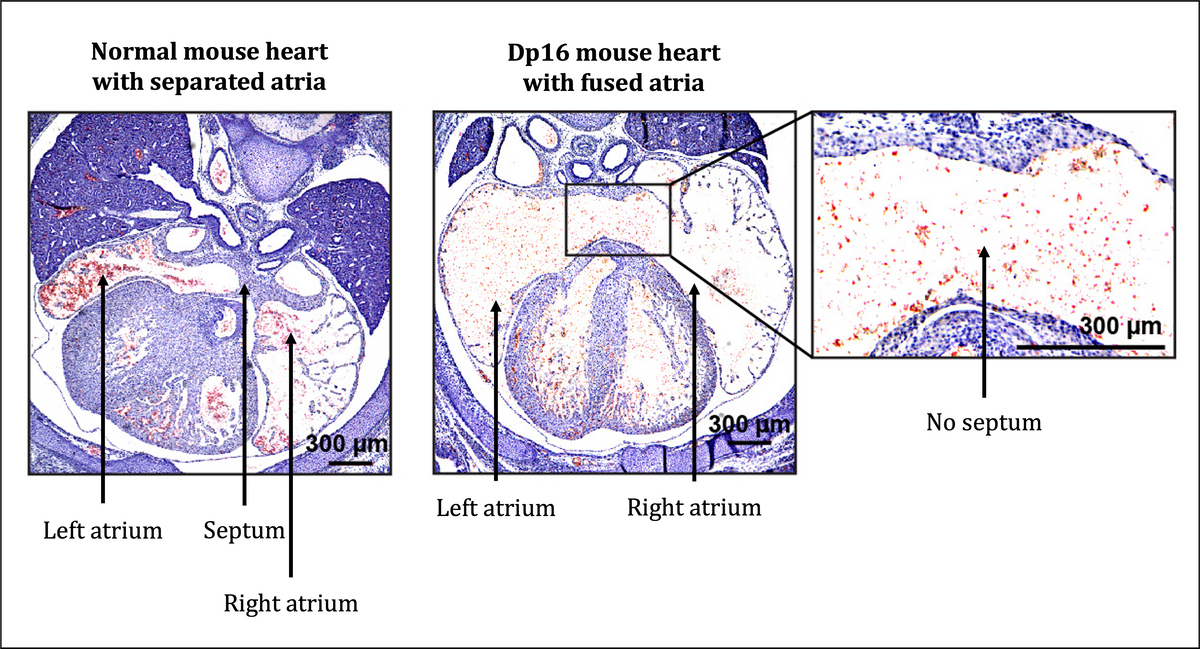 Cross-sections of mouse hearts with and without atrial septa.