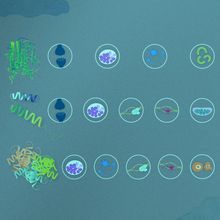 Infographic showing how neurodegenerative diseases have long been associated with aggregations of apparently toxic proteins