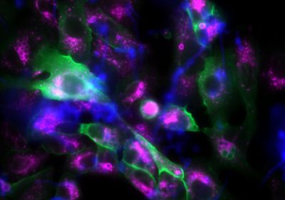 Epithelial cells and fungal spores are marked with fluorescent dyes. Cells have an irregular shape and are shown in green and blue colors. Spores are spherical in shape and are labeled green if they are surrounded by p11 protein. A protein in mature phagosomes is labeled violet.