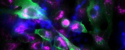 Epithelial cells and fungal spores are marked with fluorescent dyes. Cells have an irregular shape and are shown in green and blue colors. Spores are spherical in shape and are labeled green if they are surrounded by p11 protein. A protein in mature phagosomes is labeled violet.