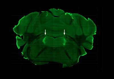 A cross-section of mouse brain showing the locus coeruleus in fluorescent green