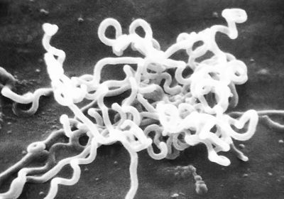 A cluster of spiral-shaped Treponema pallidum bacteria, the causative agent of syphilis.